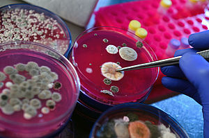 verschiedene Schimmelpilze in Petrischalen