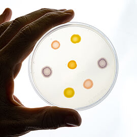 Petri dish in light