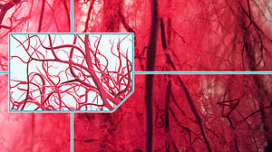 Beispielgrafik von einem Gewirr aus Blutgefäßen aus denen klar und ohne Hintergrund einzelne Blutgefäße vergrößert wurden.