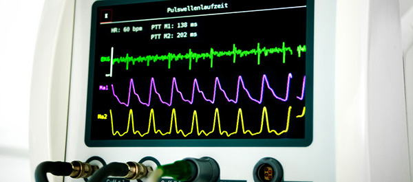 Cardiovascular Diagnostics - AIT Austrian Institute Of Technology